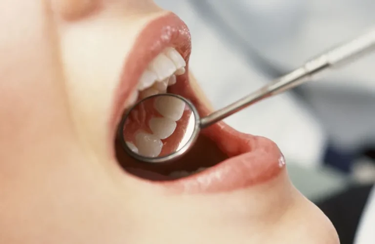 Falls Church Dental Problems That Are Common What to Know